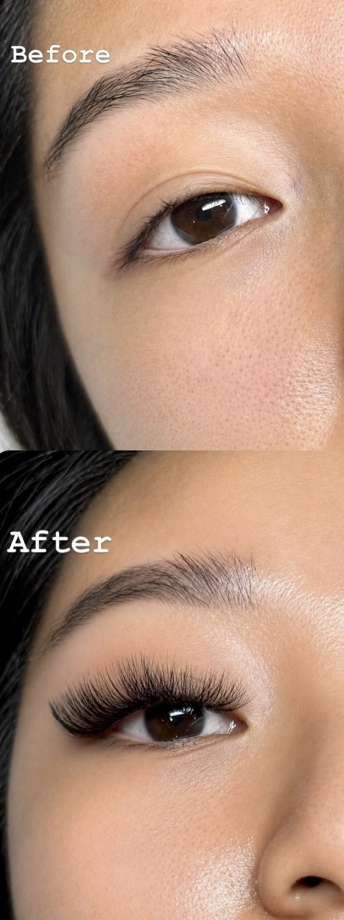 Before & After